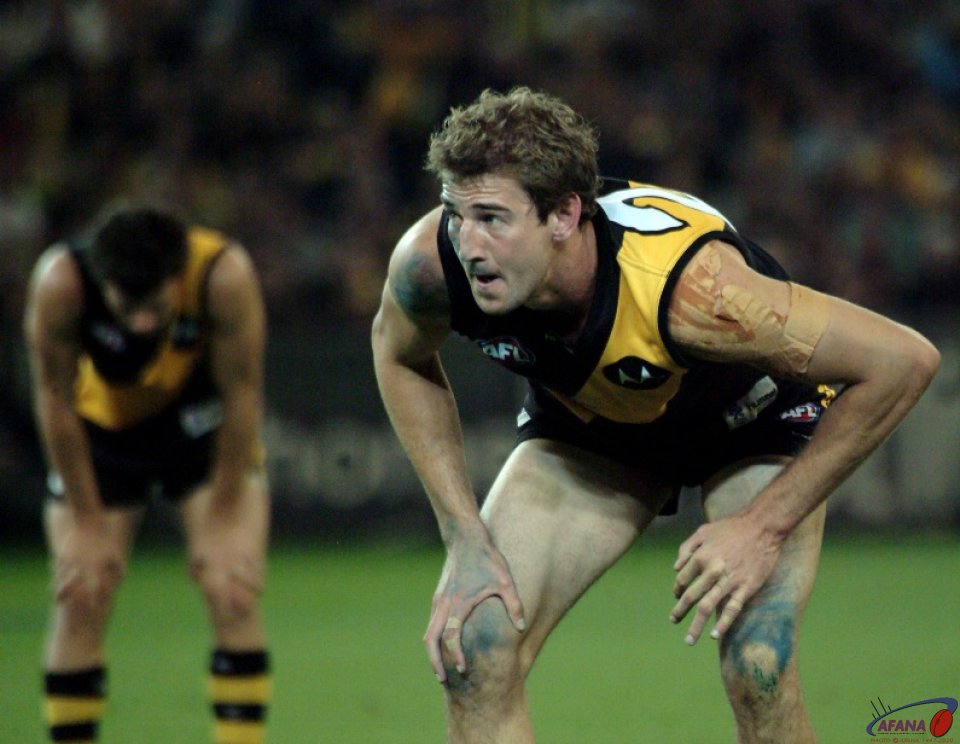 [b]The Richmond Tigers ruckman shows the scars of battle[/b]