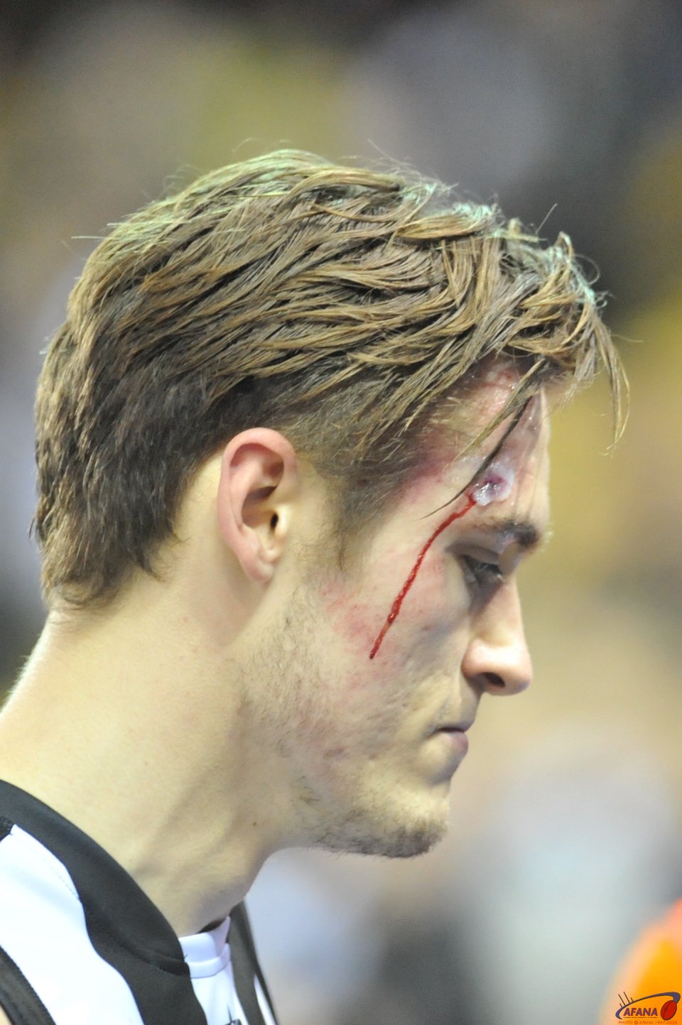 The spoils of battle, Moore heads to the rooms at half time face bleeding